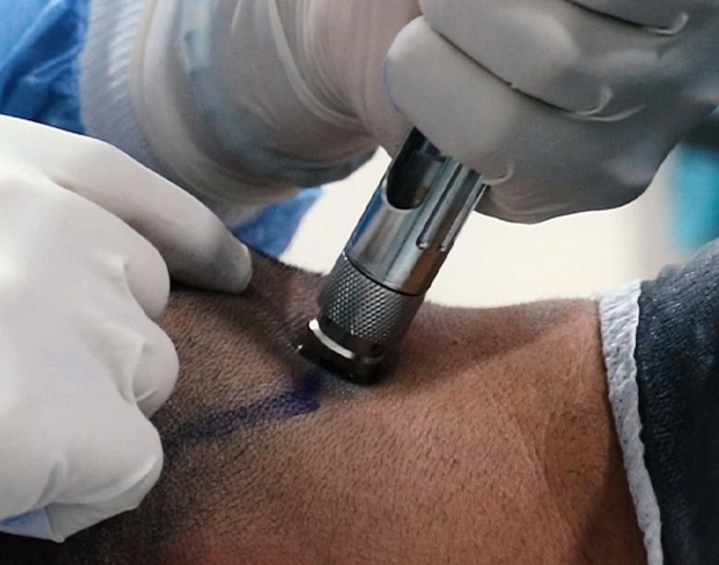 non invasive anesthesia